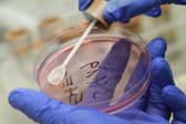 A person in the UK has died in an E.coli outbreak. (Photo: Sean Gallup/Getty Images)