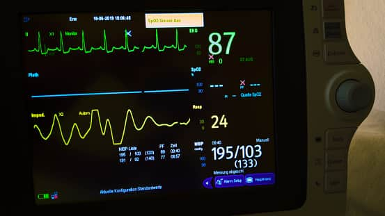 British Heart Foundation said the number of people with a heart rhythm condition has passed 1.5 million.