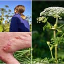 Warnings have been issued over the giant hogweed plant (Photos: Shutterstock)