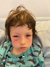 Lawrence, 8, after he was gassed by police after being caught in a pro-Palestine protest in Paris.