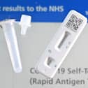Cases of Covid are on the rise thanks to the new XEC Covid variant.