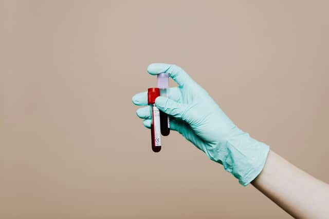 Cases of HIV amongst heterosexual patients in England have risen by more than 30% since 2022.