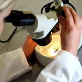 A smear test is analysed