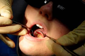 NHS dental check ups in Milton Keynes dropped significantly during lockdown