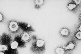 MK has recorded four new cases of coronavirus in 24 hours