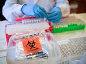 MK records 14 new cases of coronavirus over the weekend