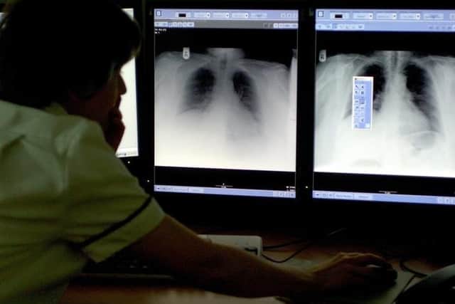 The rate of tuberculosis in Milton Keynes rose slightly last year, new figures show.