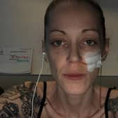 Hannah when she was in hospital earlier this year. The tube has now been removed
