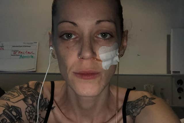 Hannah when she was in hospital earlier this year. The tube has now been removed