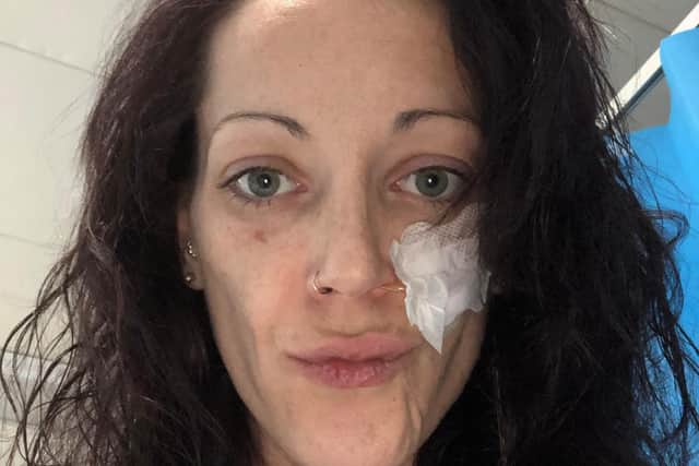 Hannah Bowen pictured being tube fed earlier this year. The tube has now been removed