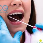 Swabs have to be taken