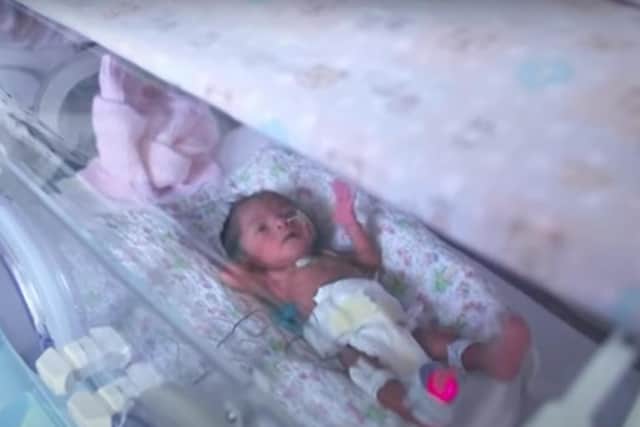 One of the miracle twins. Photo: Channel 4 News