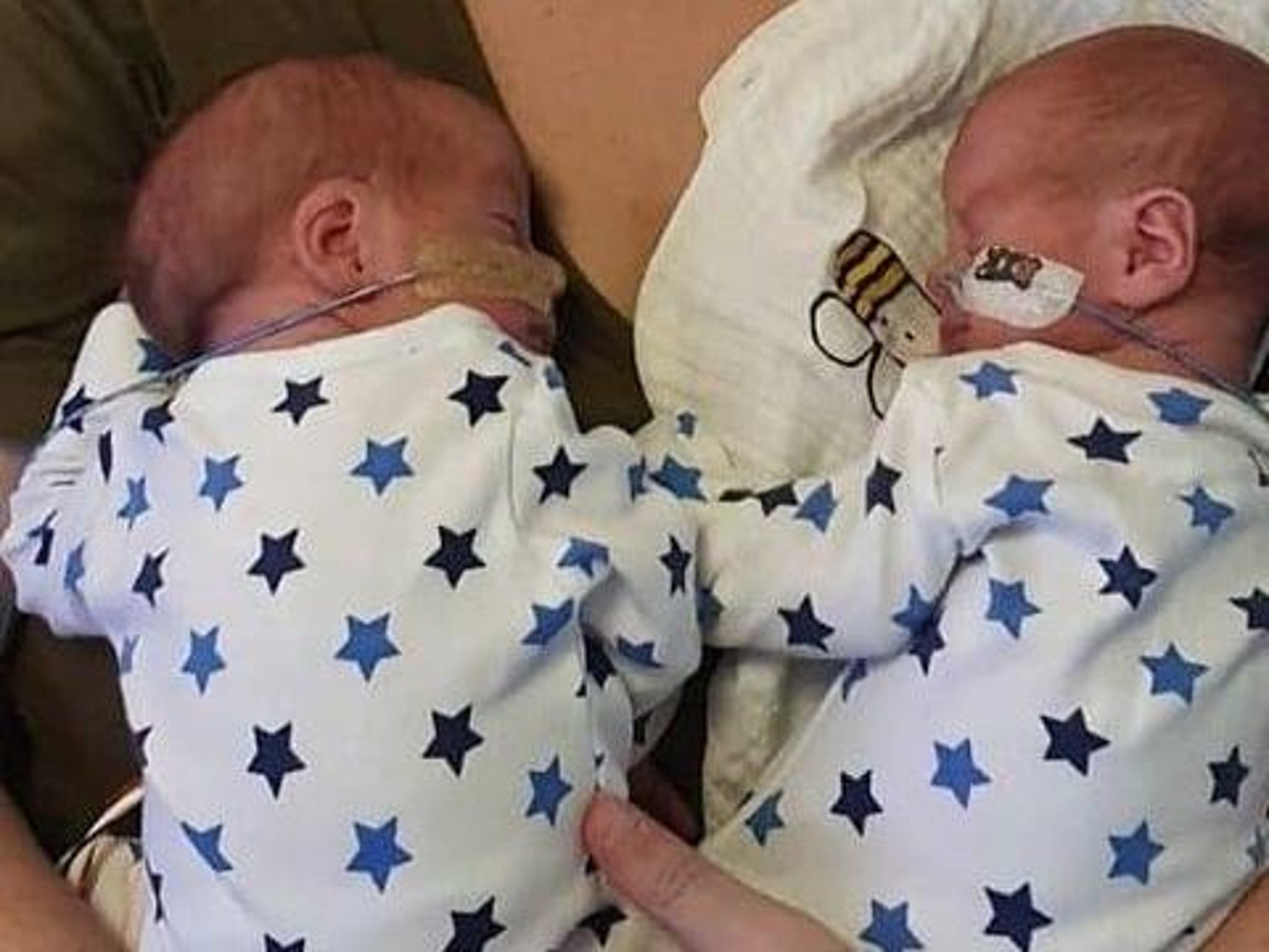 Milton twins pregnancy