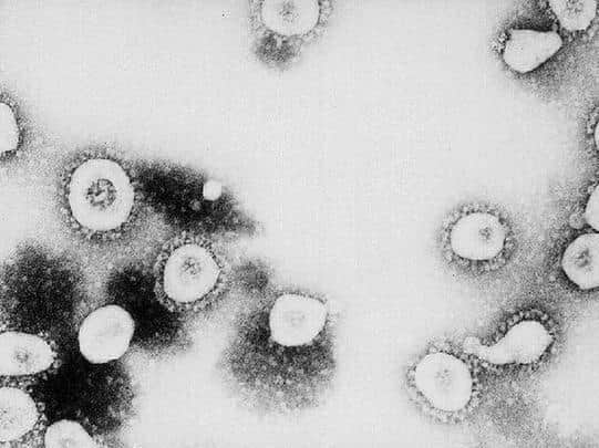 A Bucks resident has returned a positive Coronavirus test containing the South African variant