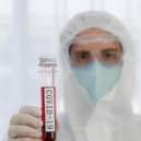 Milton Keynes has one of the lowest infection rates in England