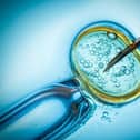 More people in MK could be given the chance to have one cycle of IVF on the NHS