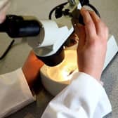 A smear test is analysed