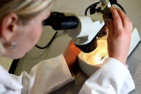 A smear test is analysed
