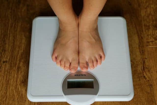 Childhood obesity has increased over the past decade