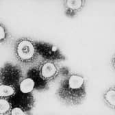 Three new Coronavirus cases were confirmed in Milton Keynes on May 5