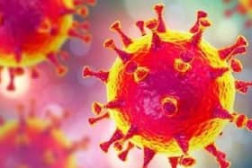 Virus
