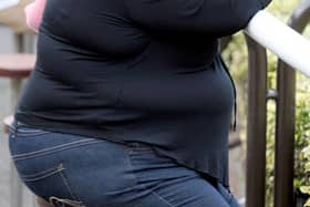 In Milton Keynes there were 4,235 hospital admissions where obesity was a primary or secondary factor in 2019-20