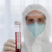19 new Covid cases in MK today