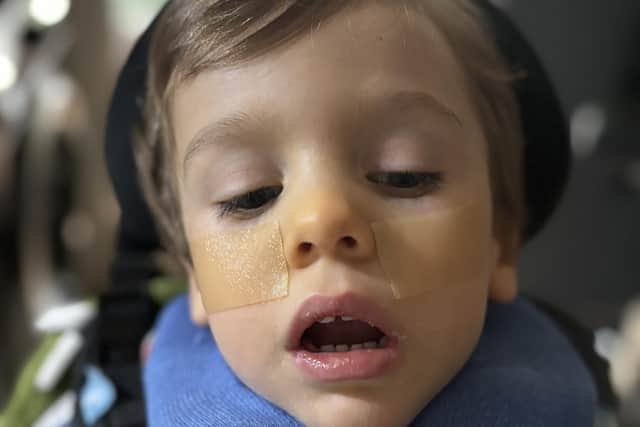 Little Ethan forgets to breath due to his rare neurological disease