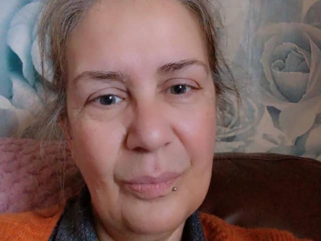 Christine Gurney has to shave every day to keep her facial hair at bay. But she's now letting it grow for an excellent cause.