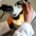 Targets to eliminate cervical cancer are 'challenging' says the Cervical Cancer Trust.
PA Photo : David Davies.
