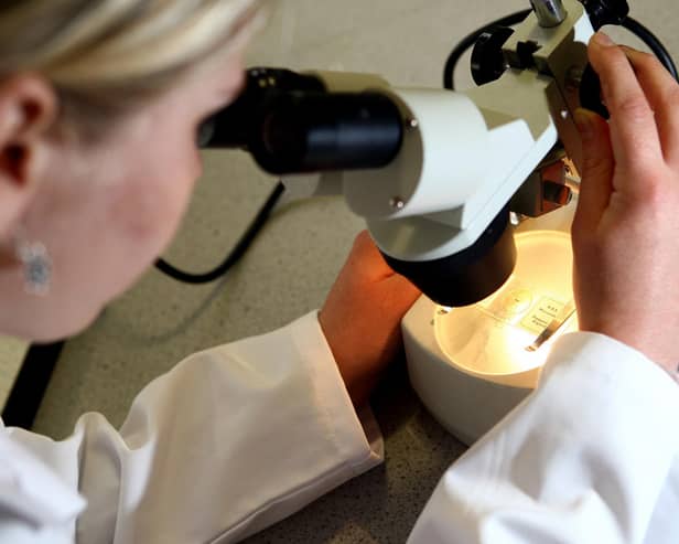 Targets to eliminate cervical cancer are 'challenging' says the Cervical Cancer Trust.
PA Photo : David Davies.