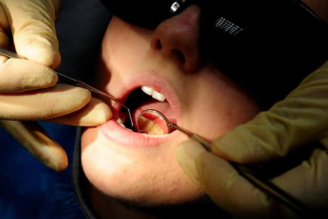 There were 100 hospital admissions to remove children's decaying teeth last year