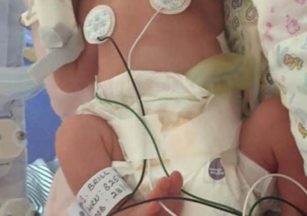Oscar as a baby in MK hospital's neonatal unit