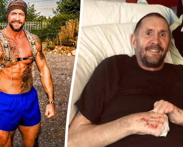 A once super-fit personal trainer is having learning to walk again after both legs and all his fingers were amputated when he suffered life-threatening sepsis. Health-conscious James MacKay, 52, from Cranfield developed a cough that wouldn't go away. PHOTOS: SWNS