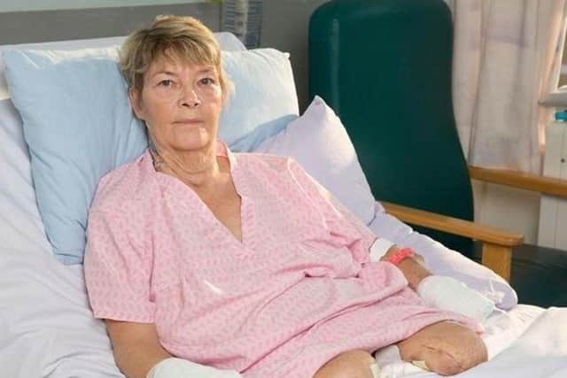 Kim Smith spent weeks recovering in MK Hospital after her quadruple amputation