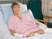 Kim Smith spent weeks recovering in MK Hospital after her quadruple amputation