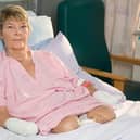 Kim Smith had all four limbs amputated to save her life after sepsis