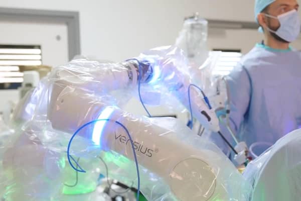 The robot surgeon arm in action at Milton Keynes hospital