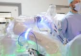 The robot surgeon arm in action at Milton Keynes hospital