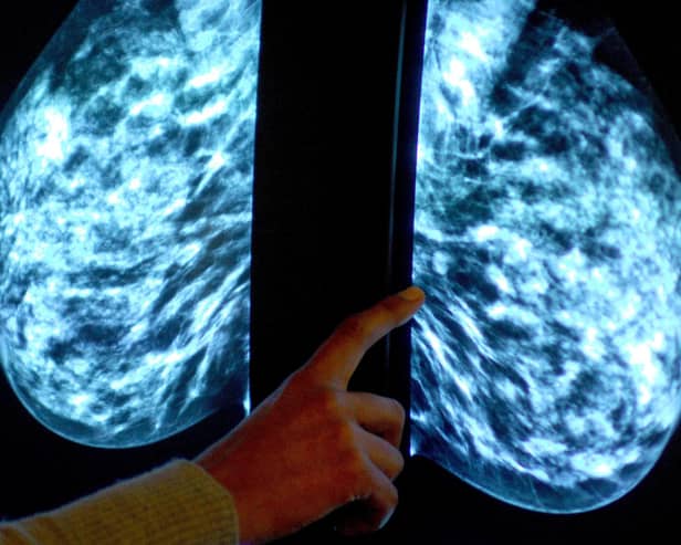 The number of women opting for a routine breast screening mammogram is below that of the pandemic