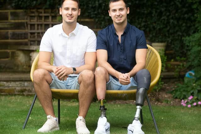James was born prematurely at 28 weeks with his twin brother Tom, due to a condition called twin-to-twin transfusion - where one gets more blood than the other