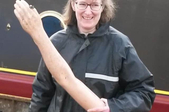 A member of the clean-up crew with the arm found in the canal