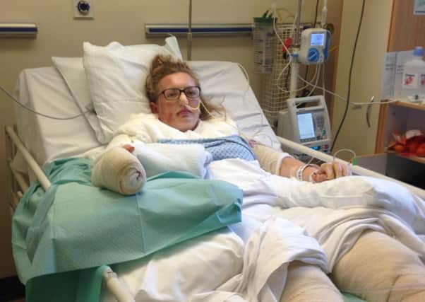 Georgina Chalmers suffered extensive burns after a gas canister exploded at Camp Bestival