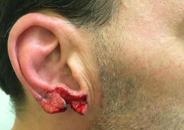 Ricky Power's bloody ear straight after assault. Â© SWNS.com